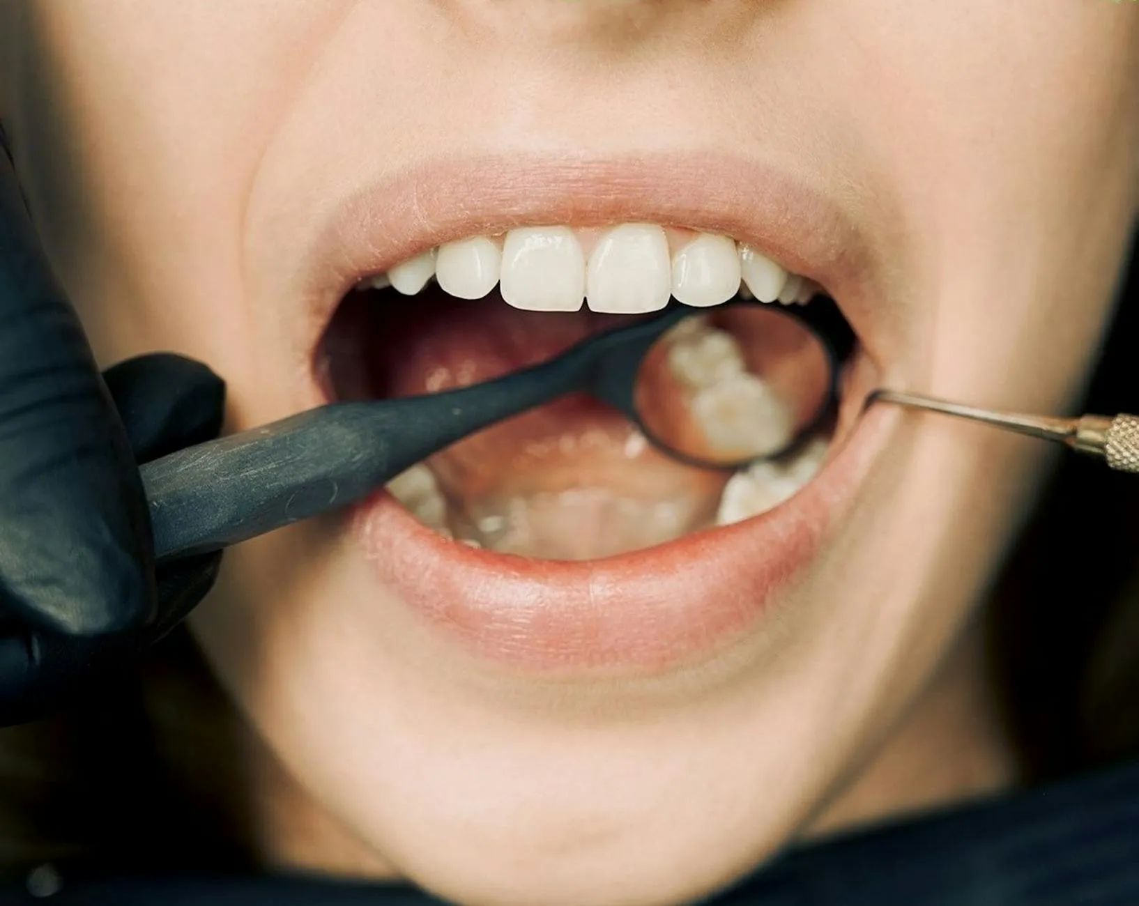 Detailní záběr na nástroje dentální hygieny při čištění zubů